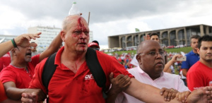 7mar2015-manifestante-fica-ferido-durante-protesto-organizado-por-cut-central-unica-dos-trabalhadores-une-uniao-nacional-dos-estudantes-e-mst-movimento-dos-trabalhadores-rurai