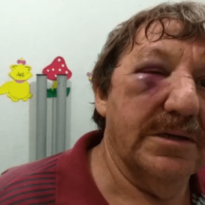 Mais violência: Padre de 64 anos é agredido no rosto durante caravana de Lula no&nbsp;PR