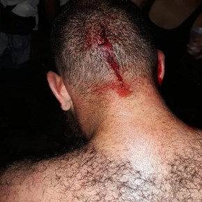 Assassinato, agressões e ataques a jornalistas e pessoas nas redes sociais são perpetrados por fascistas em todo&nbsp;Brasil