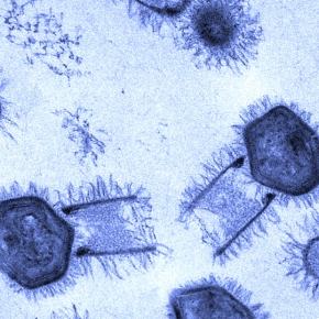 Variante brasileira de outro Vírus em circulação provoca sequelas e mortes como COVID-19, mas passa&nbsp;desapercebido